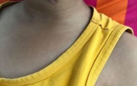 Nghịch súng, anh 9 tuổi bắn xuyên cổ em trai 6 tuổi Nghịch súng, anh 9 tuổi bắn xuyên cổ em trai 6 tuổi