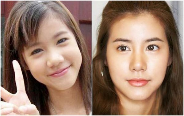 Đời lên tiên khi sao Thái thẩm mỹ: Davika tuyệt đẹp nhưng ‘sốc’ nhất là mỹ nam ‘Sự quyến rũ xấu xa’