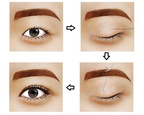 Những Lưu Ý Quan Trọng Khi Nhấn Mí
