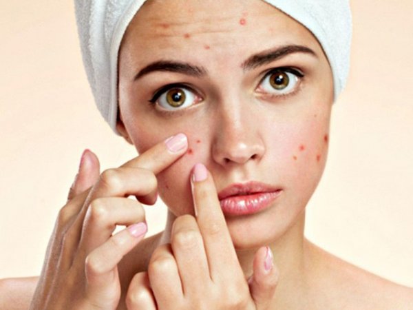 5 Sản phẩm chăm sóc da dầu mụn bạn cần phải có ngay!